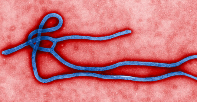 Virus Ebola/Foto: CDC/wikipedia